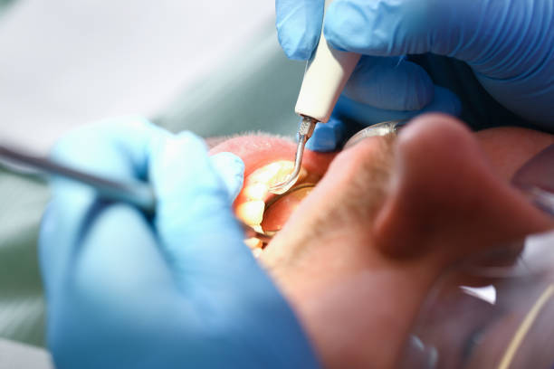 Best Urgent Care for Lost Fillings or Crowns in Maypearl, TX