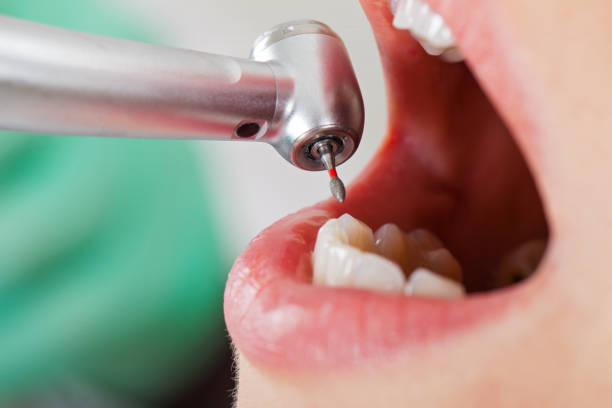 Best Cosmetic Emergency Dentistry in Maypearl, TX
